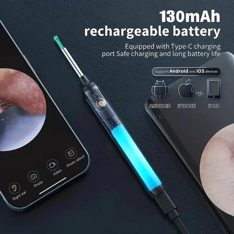 SmartScope™ Ear Wax Remover – HD Camera + LED Light System