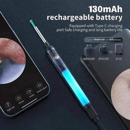 SmartScope™ Ear Wax Remover – HD Camera + LED Light System