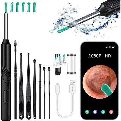 SmartScope™ Ear Wax Remover – HD Camera + LED Light System