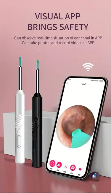 SmartScope™ Ear Wax Remover – HD Camera + LED Light System